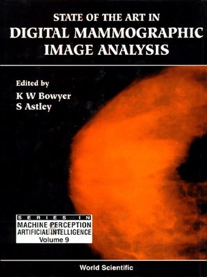 cover image of State of the Art In Digital Mammographic Image Analysis